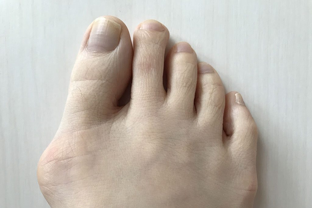 足裏の痛みは病気のサイン 痛みの原因と対処法 ドクターオブカイロプラクティック 長澤監修